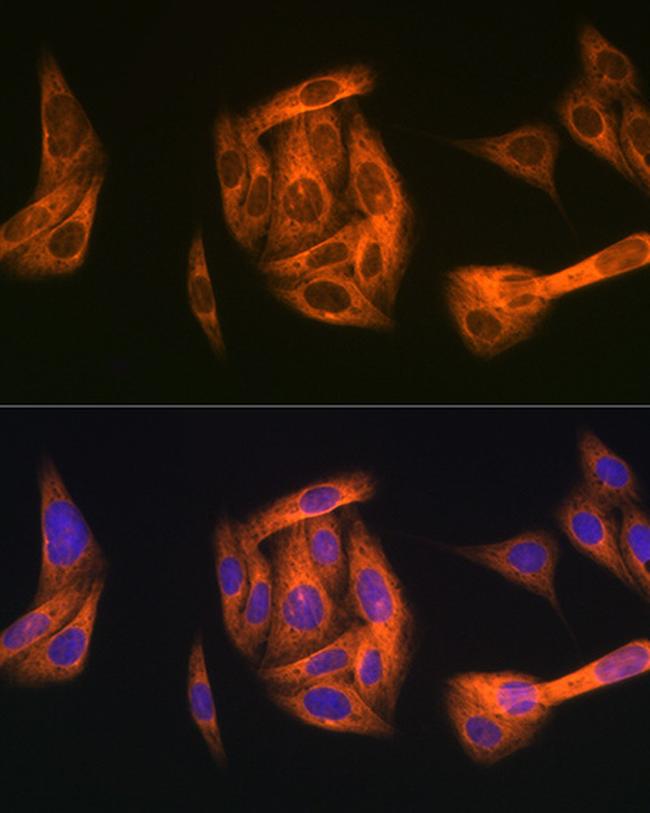 TAB1 Antibody in Immunocytochemistry (ICC/IF)