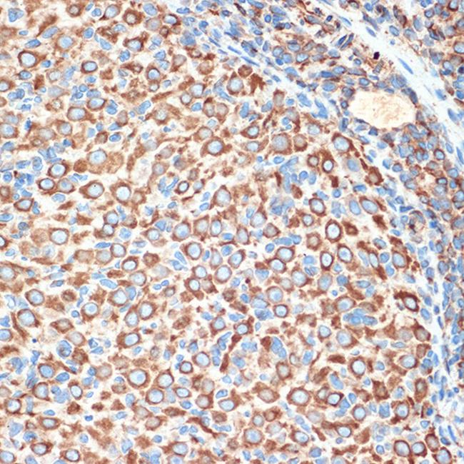 SLIT2 Antibody in Immunohistochemistry (Paraffin) (IHC (P))