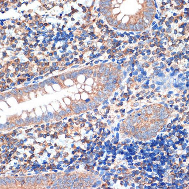 CRMP5 Antibody in Immunohistochemistry (Paraffin) (IHC (P))