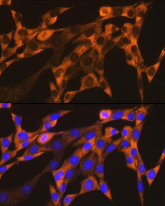 YBX1 Antibody in Immunocytochemistry (ICC/IF)