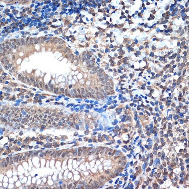 RCOR1 Antibody in Immunohistochemistry (Paraffin) (IHC (P))