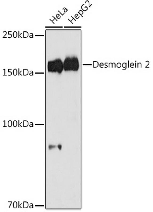 Desmoglein 2 (DSG2) Antibody in Western Blot (WB)