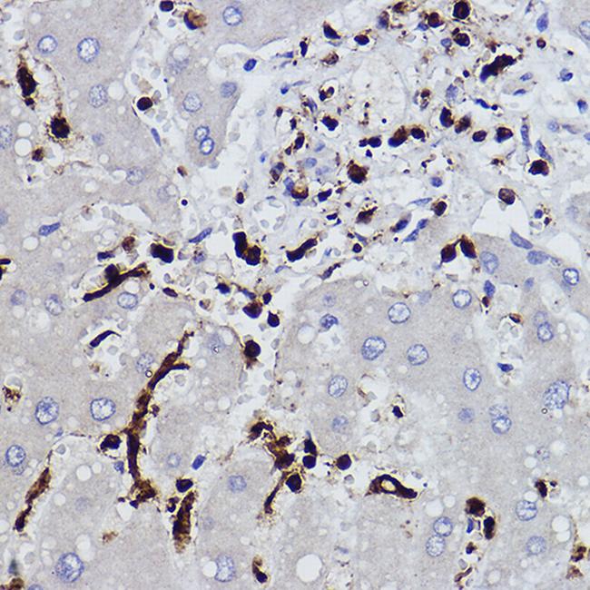 L-Plastin Antibody in Immunohistochemistry (Paraffin) (IHC (P))