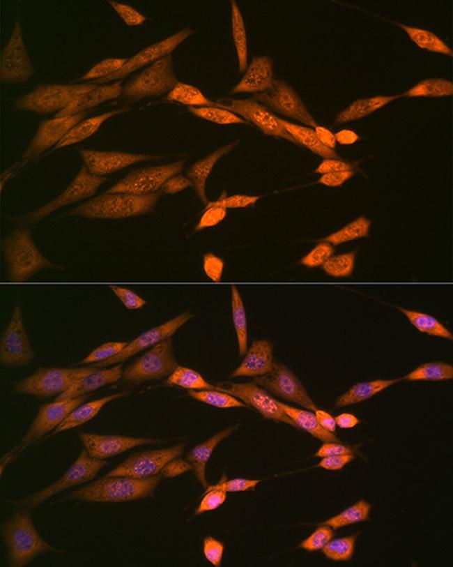 DISC1 Antibody in Immunocytochemistry (ICC/IF)