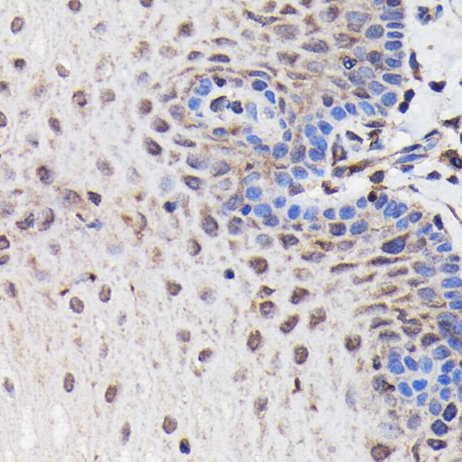 PIK3R2 Antibody in Immunohistochemistry (Paraffin) (IHC (P))