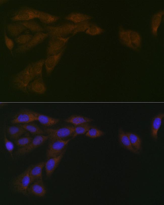 Cytochrome P450 Reductase Antibody in Immunocytochemistry (ICC/IF)