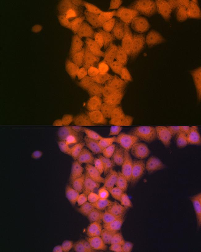 p53DINP1 Antibody in Immunocytochemistry (ICC/IF)