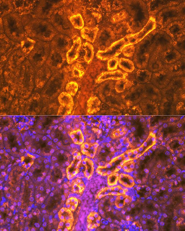 PDZK1 Antibody in Immunohistochemistry (Paraffin) (IHC (P))