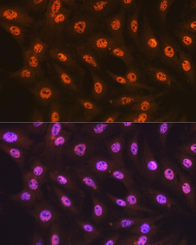 SF3B1 Antibody in Immunocytochemistry (ICC/IF)