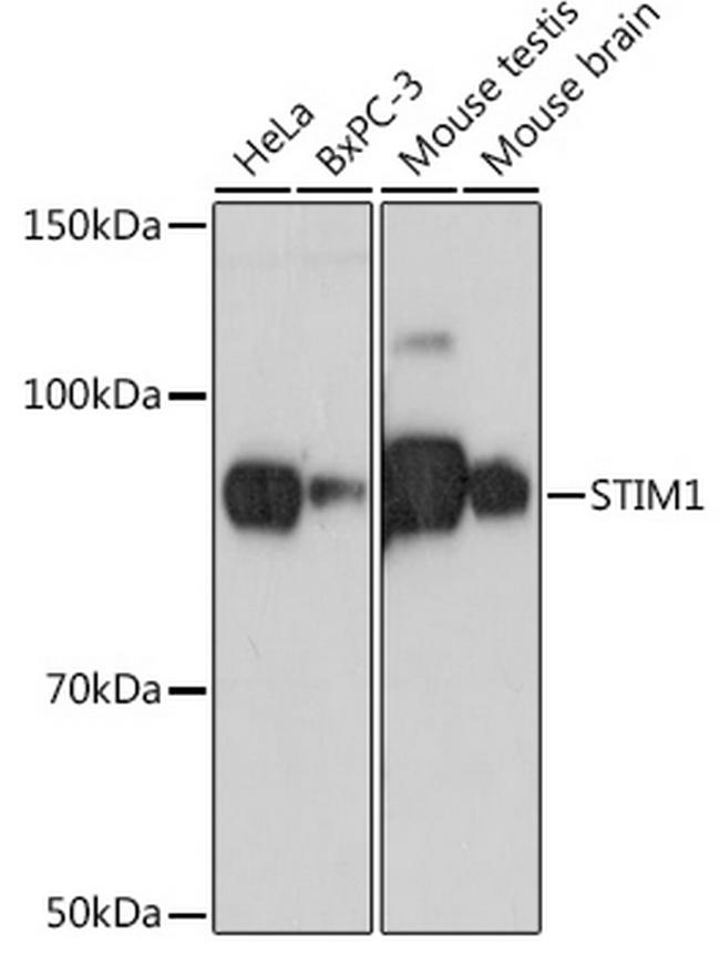 STIM1 Antibody in Western Blot (WB)