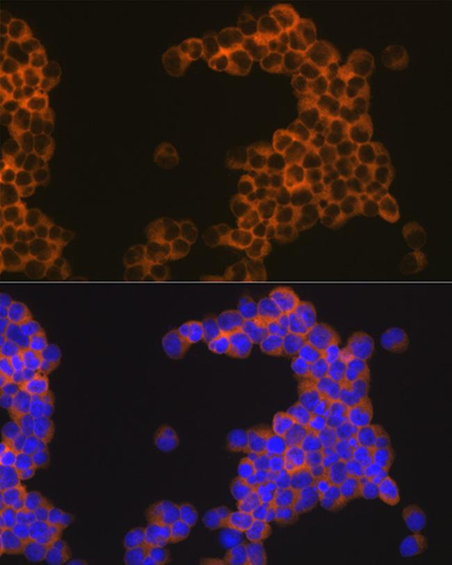 CD30 Antibody in Immunocytochemistry (ICC/IF)