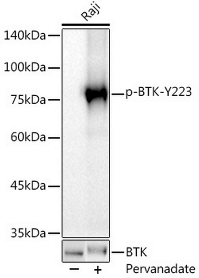 Phospho-BTK (Tyr223) Antibody in Western Blot (WB)