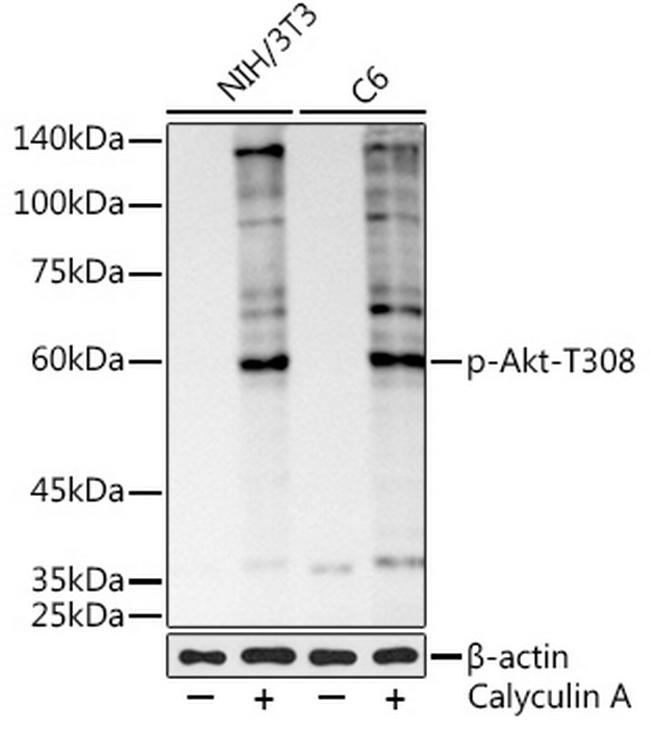 Phospho-AKT Pan (Thr308, Thr305, Thr309) Antibody in Western Blot (WB)