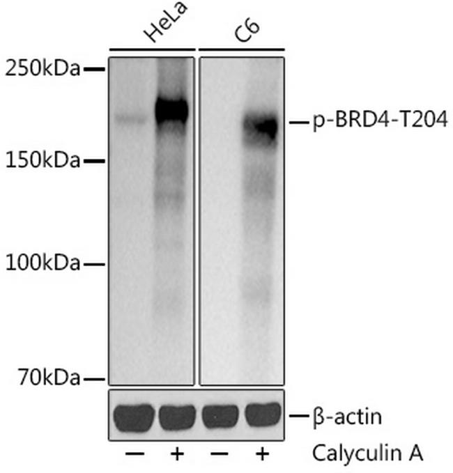 Phospho-BRD4 (Thr204) Antibody in Western Blot (WB)