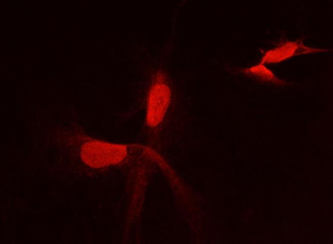 PFDN2 Antibody in Immunocytochemistry (ICC/IF)