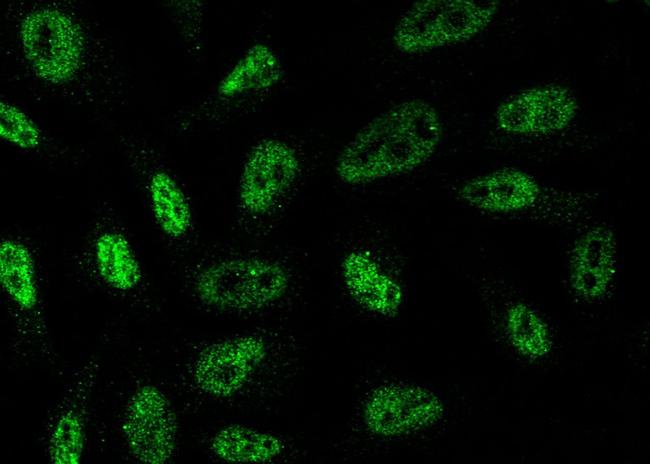 Brachyury Antibody in Immunocytochemistry (ICC/IF)