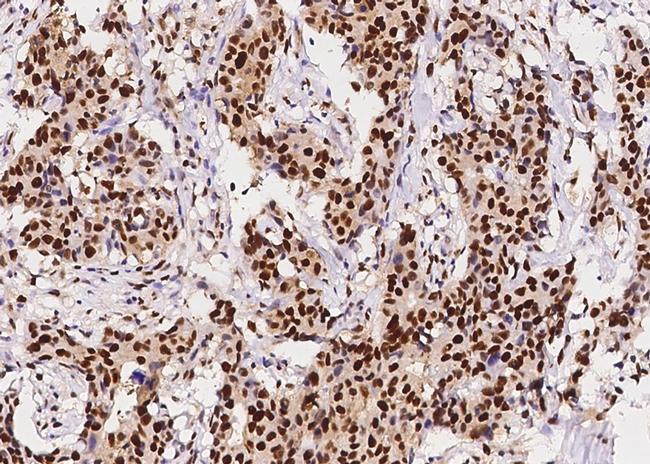 PCNA Antibody in Immunohistochemistry (Paraffin) (IHC (P))