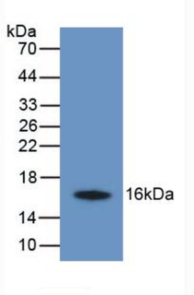 TMEM27 Antibody in Western Blot (WB)