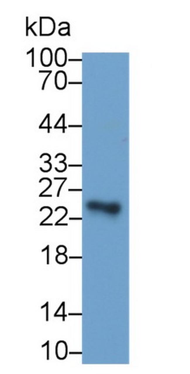 Sostdc1 Antibody in Western Blot (WB)