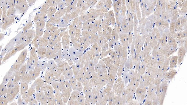 SEMA5B Antibody in Immunohistochemistry (Paraffin) (IHC (P))