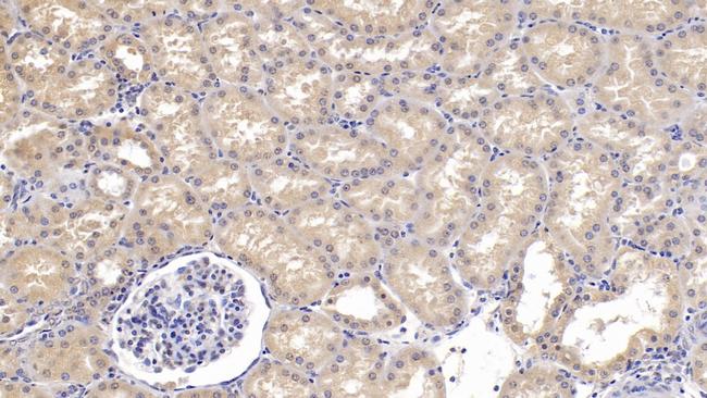 SEMA3A Antibody in Immunohistochemistry (Paraffin) (IHC (P))