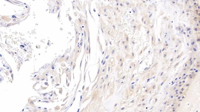 ROS1 Antibody in Immunohistochemistry (Paraffin) (IHC (P))