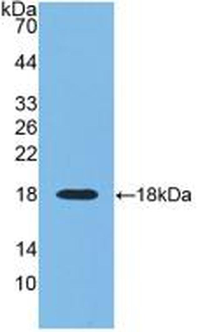 RNASE3 Antibody in Western Blot (WB)