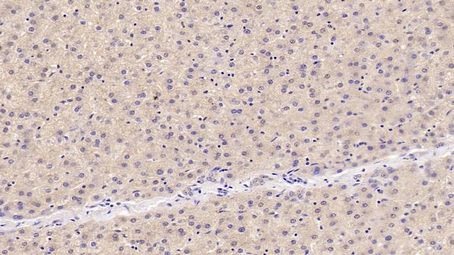 OAS1 Antibody in Immunohistochemistry (Paraffin) (IHC (P))