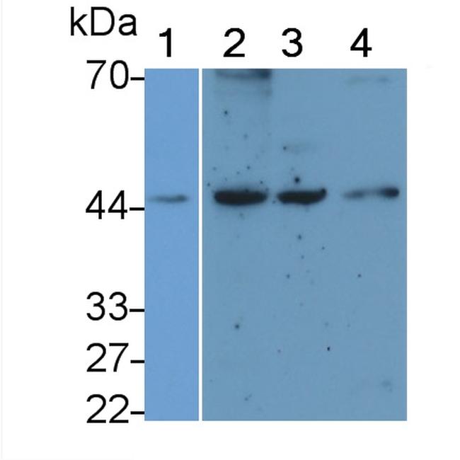 Podocin Antibody in Western Blot (WB)