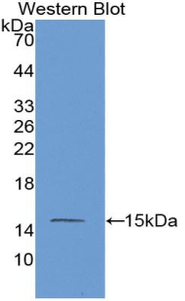 MASP2 Antibody in Western Blot (WB)