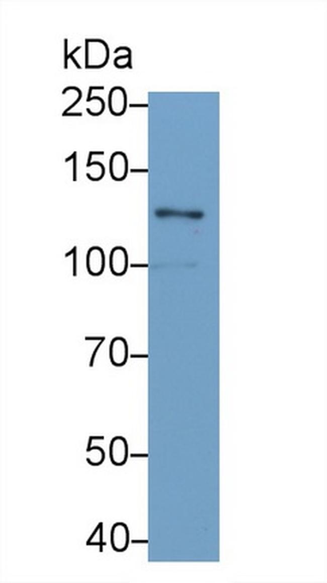 Laminin gamma-2 Antibody in Western Blot (WB)