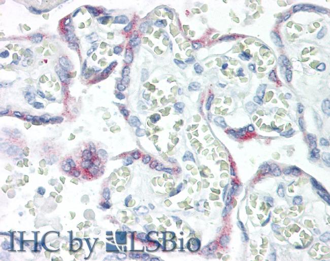 KISS1 Antibody in Immunohistochemistry (Paraffin) (IHC (P))