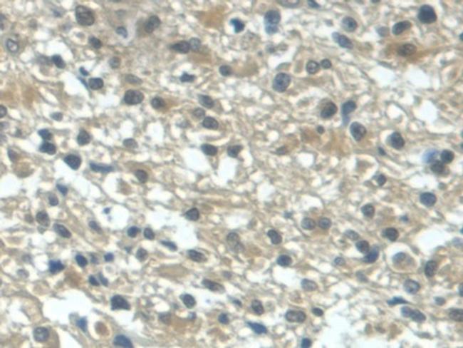 TGF alpha Antibody in Immunohistochemistry (Paraffin) (IHC (P))