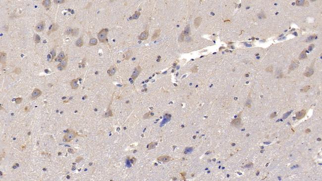 IL-29 Antibody in Immunohistochemistry (Paraffin) (IHC (P))