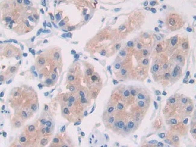 IL-28A Antibody in Immunohistochemistry (Paraffin) (IHC (P))