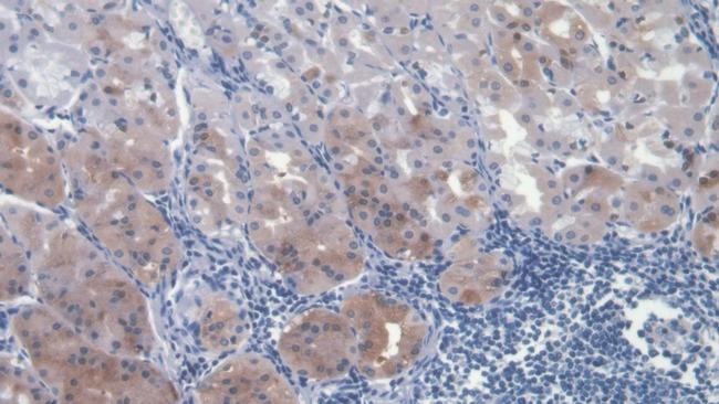 HGF Antibody in Immunohistochemistry (Paraffin) (IHC (P))