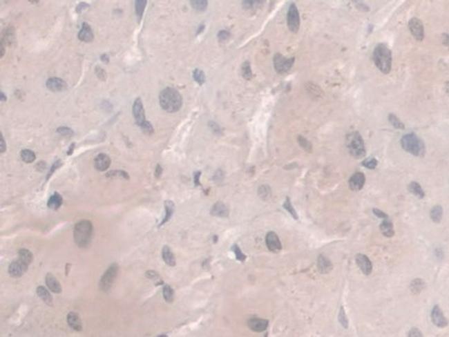 HFE2 Antibody in Immunohistochemistry (Paraffin) (IHC (P))