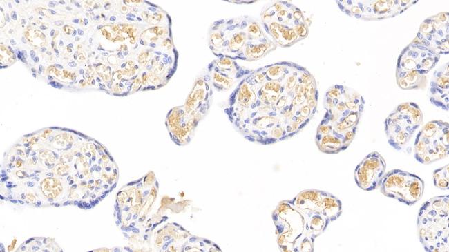 FIBB Antibody in Immunohistochemistry (Paraffin) (IHC (P))