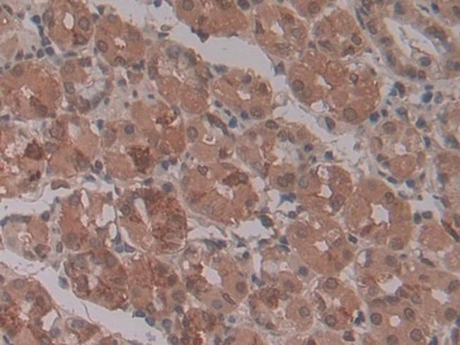 ENPP2 Antibody in Immunohistochemistry (Paraffin) (IHC (P))