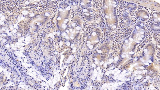 DNAH11 Antibody in Immunohistochemistry (Paraffin) (IHC (P))