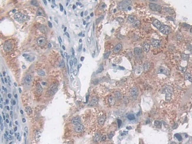 CCL20 Antibody in Immunohistochemistry (Paraffin) (IHC (P))