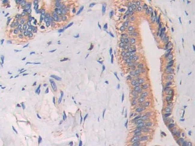 Cathelicidin Antibody in Immunohistochemistry (Paraffin) (IHC (P))