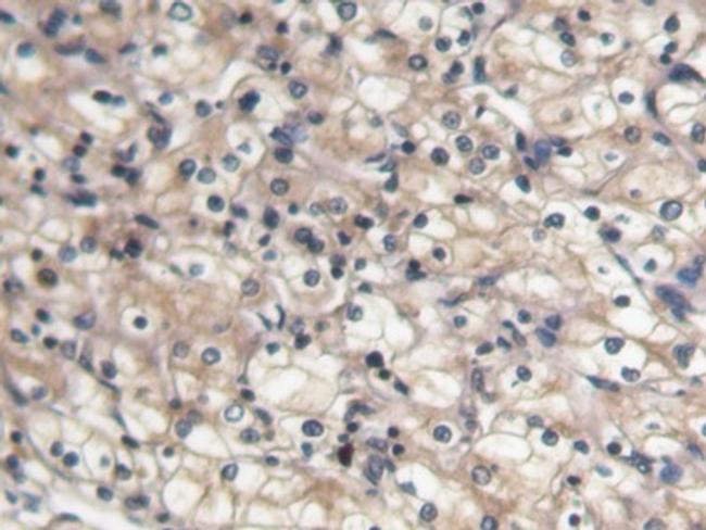 BMP-7 Antibody in Immunohistochemistry (Paraffin) (IHC (P))