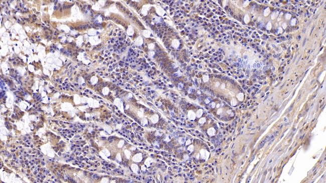 ASPH Antibody in Immunohistochemistry (Paraffin) (IHC (P))