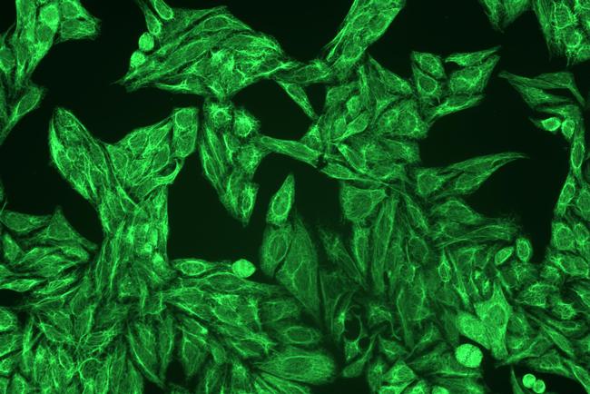 Cytokeratin 4/5/6/8/10/13/18 Antibody in Immunocytochemistry (ICC/IF)