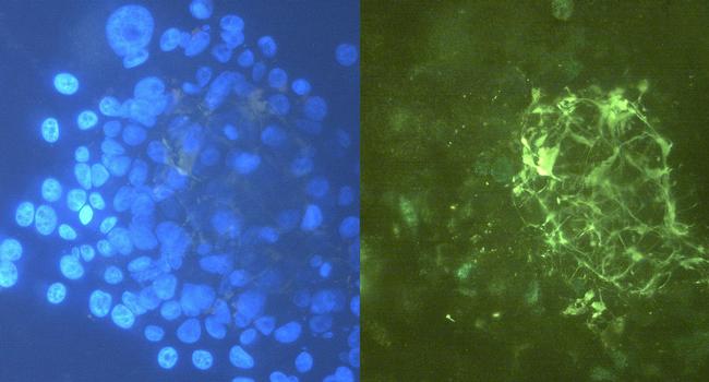 Tenascin C Antibody in Immunocytochemistry (ICC/IF)