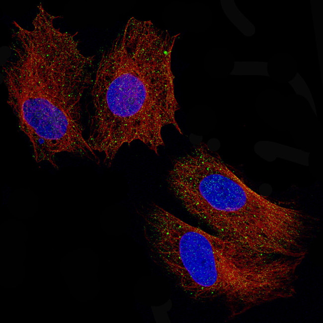 Periostin Antibody in Immunocytochemistry (ICC/IF)