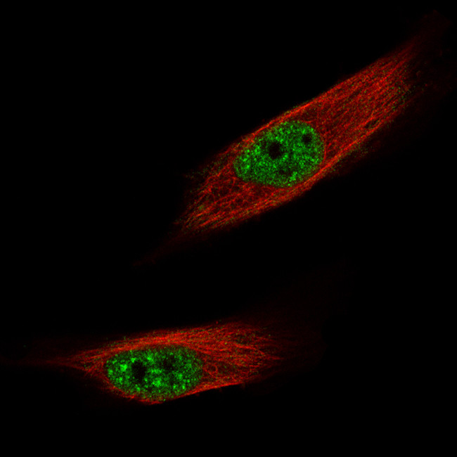 FOXM1 Antibody in Immunocytochemistry (ICC/IF)