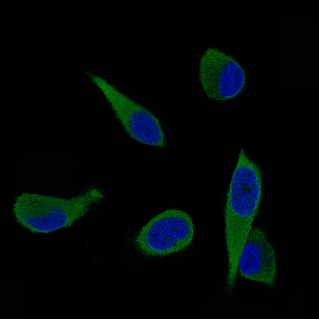 ALDH1A3 Antibody in Immunocytochemistry (ICC/IF)