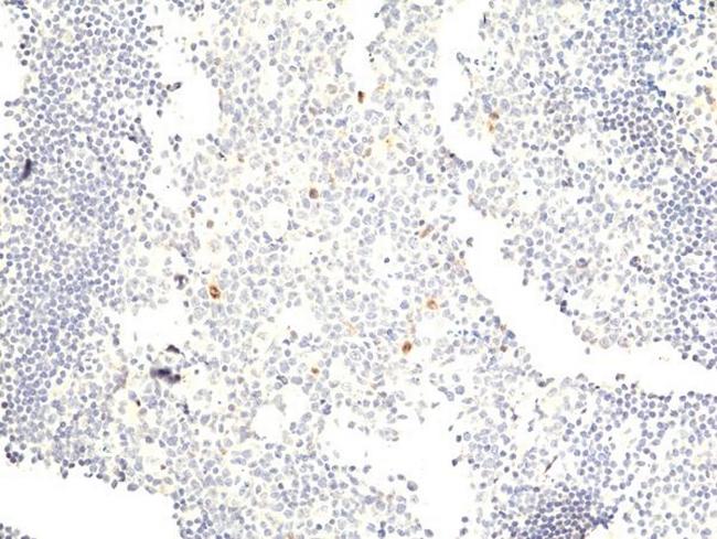 Phospho-Aurora A/B/C (Thr288, Thr232, Thr198) Antibody in Immunohistochemistry (Paraffin) (IHC (P))